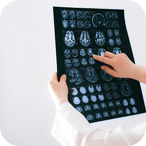 Neurology