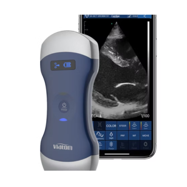 Ultrasound